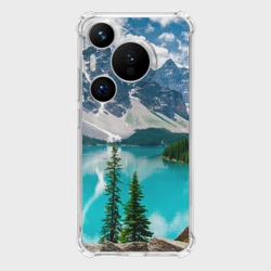Чехол для Huawei Pura 70 Озеро