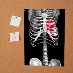 Постер Скелет с сердцем - фото 2