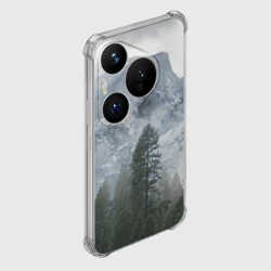 Чехол для Huawei Pura 70 Лес - фото 2