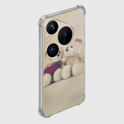Чехол для Huawei Pura 70 Pro Lovely bears - фото 2