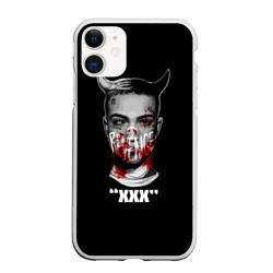 Chehly Dlya Telefonov Xxxtentacion C Printom Kupit Chehly Dlya
