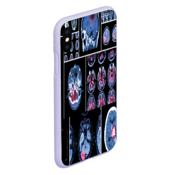 Чехол для iPhone XS Max матовый Неврология - фото 2