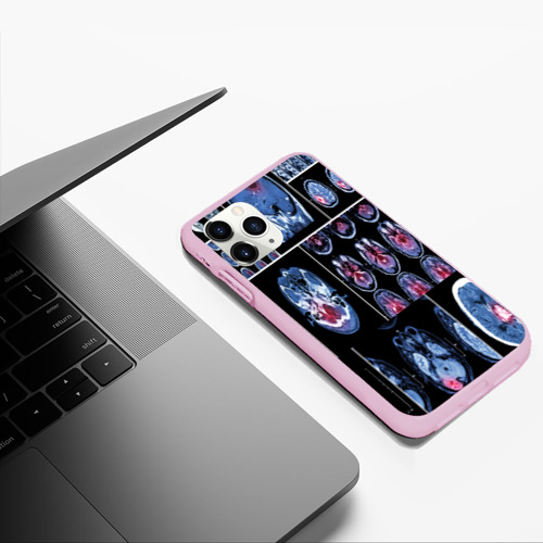 Чехол для iPhone 11 Pro Max матовый с принтом Неврология, фото #5
