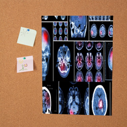 Постер Неврология - фото 2