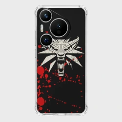Чехол для Huawei Pura 70 The Witcher Blood