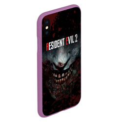 Чехол для iPhone XS Max матовый Resident Evil 2 Remake - фото 2