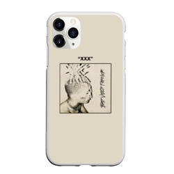 Chehly Dlya Telefonov Xxxtentacion C Printom Kupit Chehly Dlya