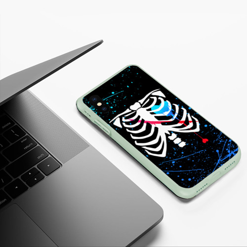 Чехол для iPhone XS Max матовый Undertale Андертейл Санс, цвет салатовый - фото 5