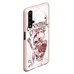 Чехол для Honor 20 Cannibal Corpse - фото 2