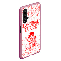 Чехол для Honor 20 Cannibal Corpse - фото 2