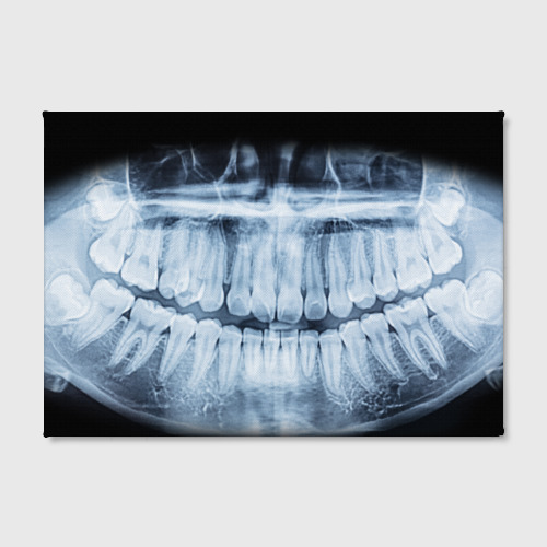 Холст прямоугольный Зубной рентген, цвет 3D печать - фото 2