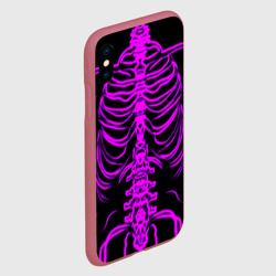 Чехол для iPhone XS Max матовый Розовые кости - фото 2