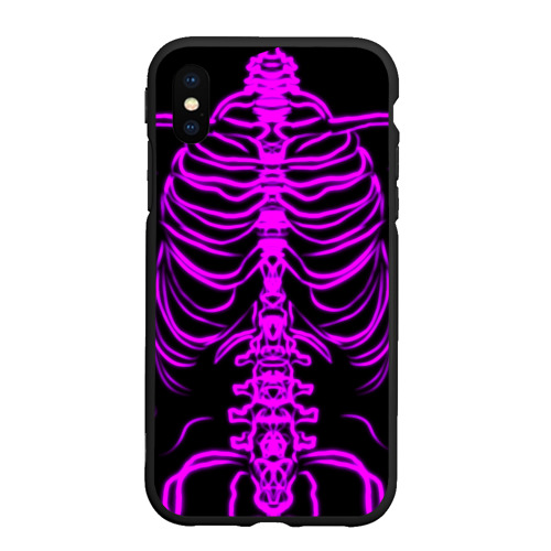 Чехол для iPhone XS Max матовый Розовые кости, цвет черный