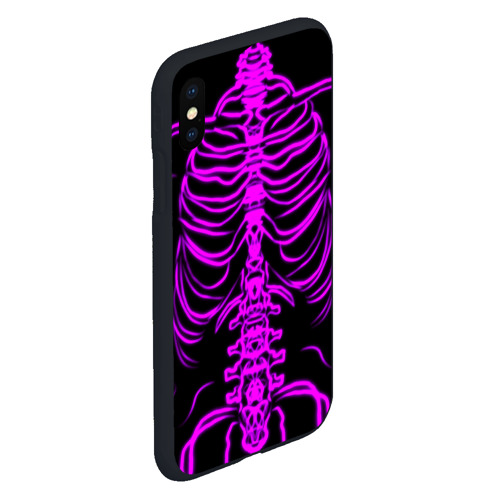 Чехол для iPhone XS Max матовый Розовые кости, цвет черный - фото 3