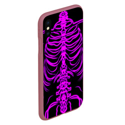 Чехол для iPhone XS Max матовый Розовые кости - фото 2