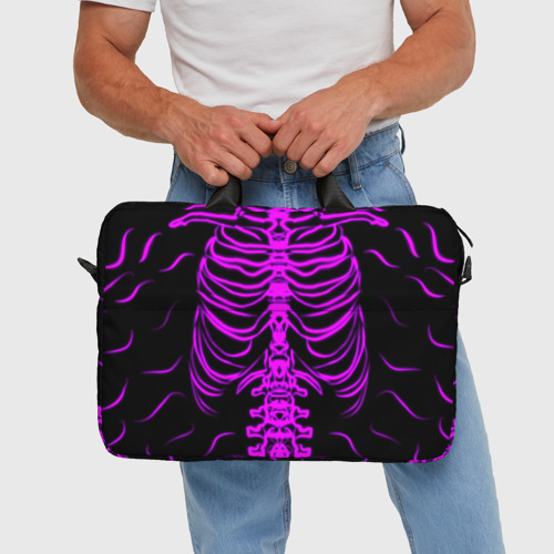 Сумка для ноутбука 3D Розовые кости, цвет 3D печать - фото 5
