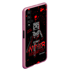 Чехол для Honor 20 Wither skeleton - фото 2