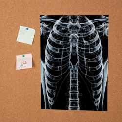 Постер Рентген твоего тела - фото 2