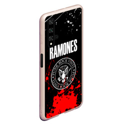 Чехол для Honor 20 Ramones краски метал группа - фото 2