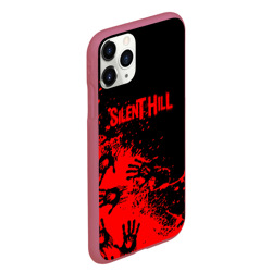 Чехол для iPhone 11 Pro Max матовый Silent hill logo game pattern steel - фото 2