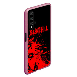 Чехол для Honor 20 Silent hill logo game pattern steel - фото 2