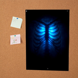 Постер Душа синяя - позвоночник и рёбра просвечиваются - фото 2